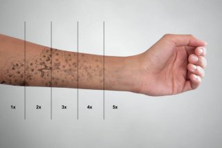 Les soins et conseils post détatouage