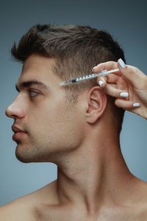 Botox pour homme : une solution efficace et naturelle pour lisser les rides et préserver son expression